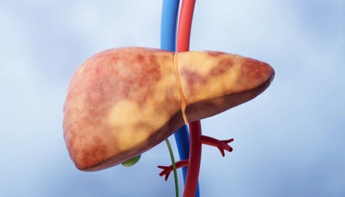 1 de 1 Ilustração colorida de fígado - Metrópoles - Foto: Getty Images