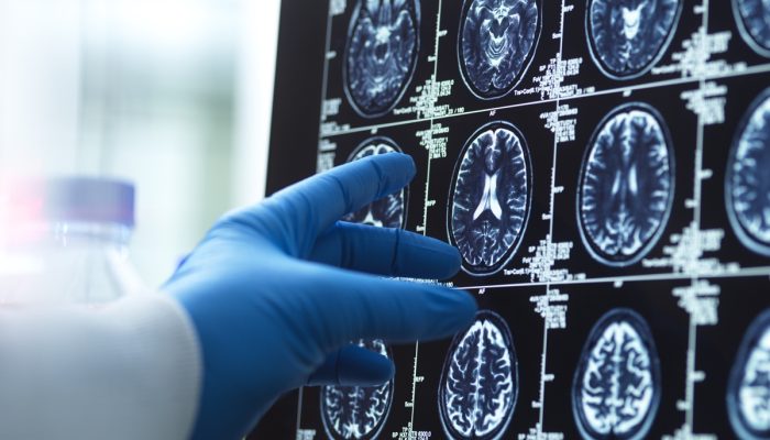 1 de 1 Foto de mão de médico segurando exame de imagem do cérebro - Geriatra lista 5 melhores ...