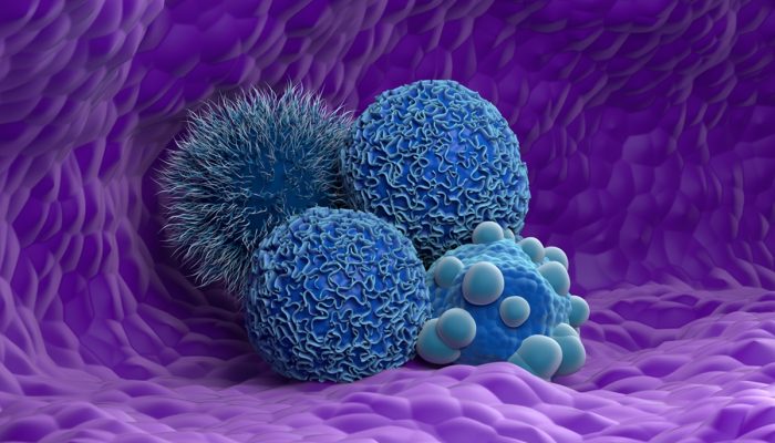 1 de 1 Ilustração mostra células cancerígenas em azul, em um fundo roxo - 6 tipos de câncer ...