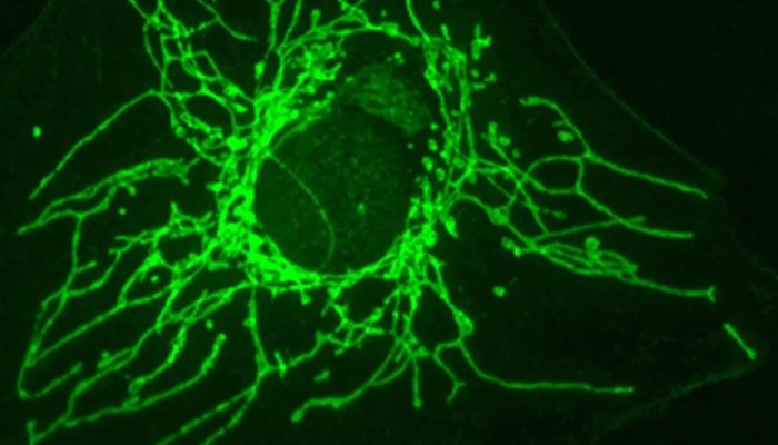 1 de 1 Célula cancerosa com mitocôndrias em verde — as centrais de energia da célula e locai...