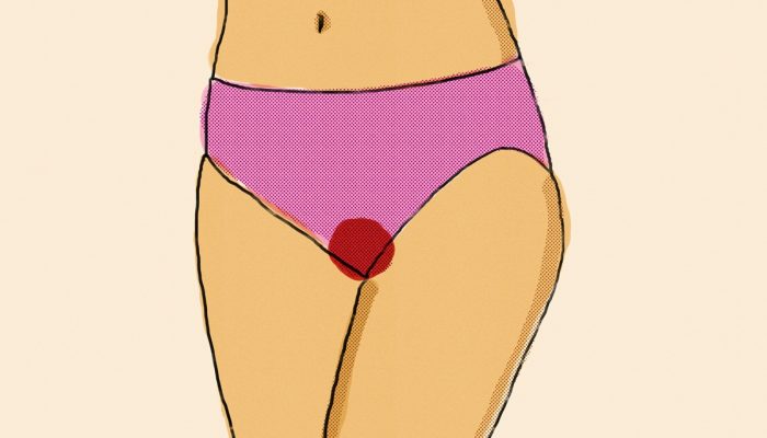 1 de 1 Ilustração mostra mulher de calcinha com uma mancha de sangue - Ginecologistas listam as...