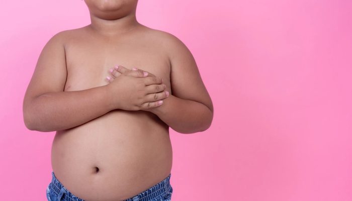 1 de 1 Menino obeso com sobrepeso em um fundo rosa. Obesidade infantil, criança acima do peso. M...