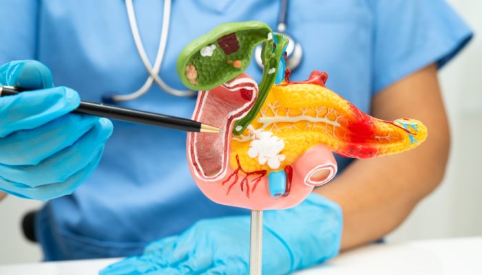 1 de 1 Foto colorida de médico com luvas apontando em direção a um pâncreas humano de mentira...