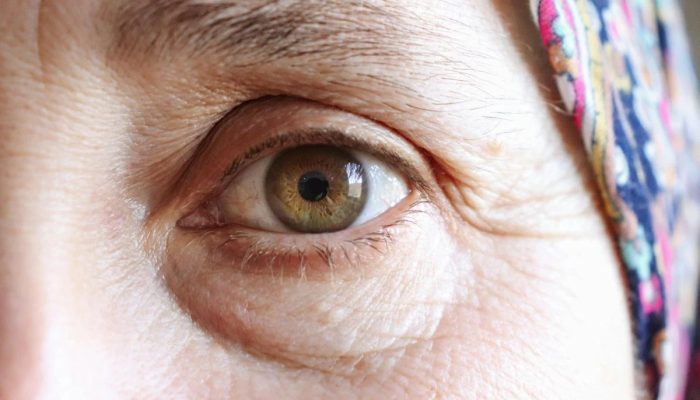 1 de 1 visão mulher / olhos - Foto: Canva