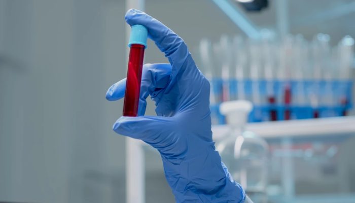 1 de 1 Close de um tubo de coleta a vácuo de vidro contendo solução de DNA para teste em labor...