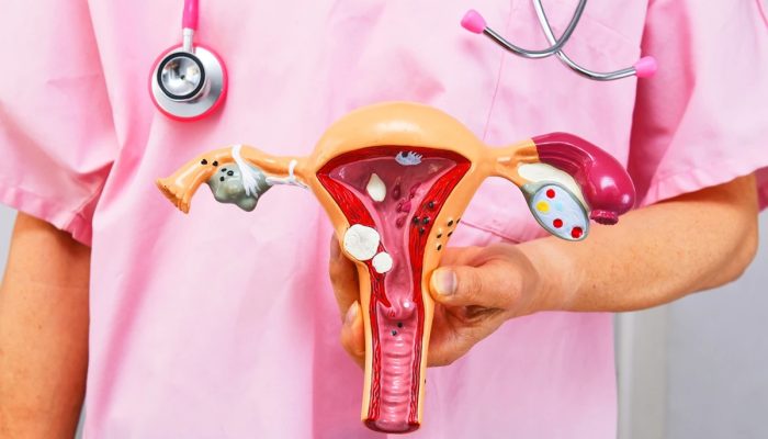 1 de 1 Cirurgião segurando modelo anatômico de patologias comuns. Conceito de câncer ou endome...